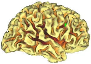 Nuevo atlas del cerebro (PALS)